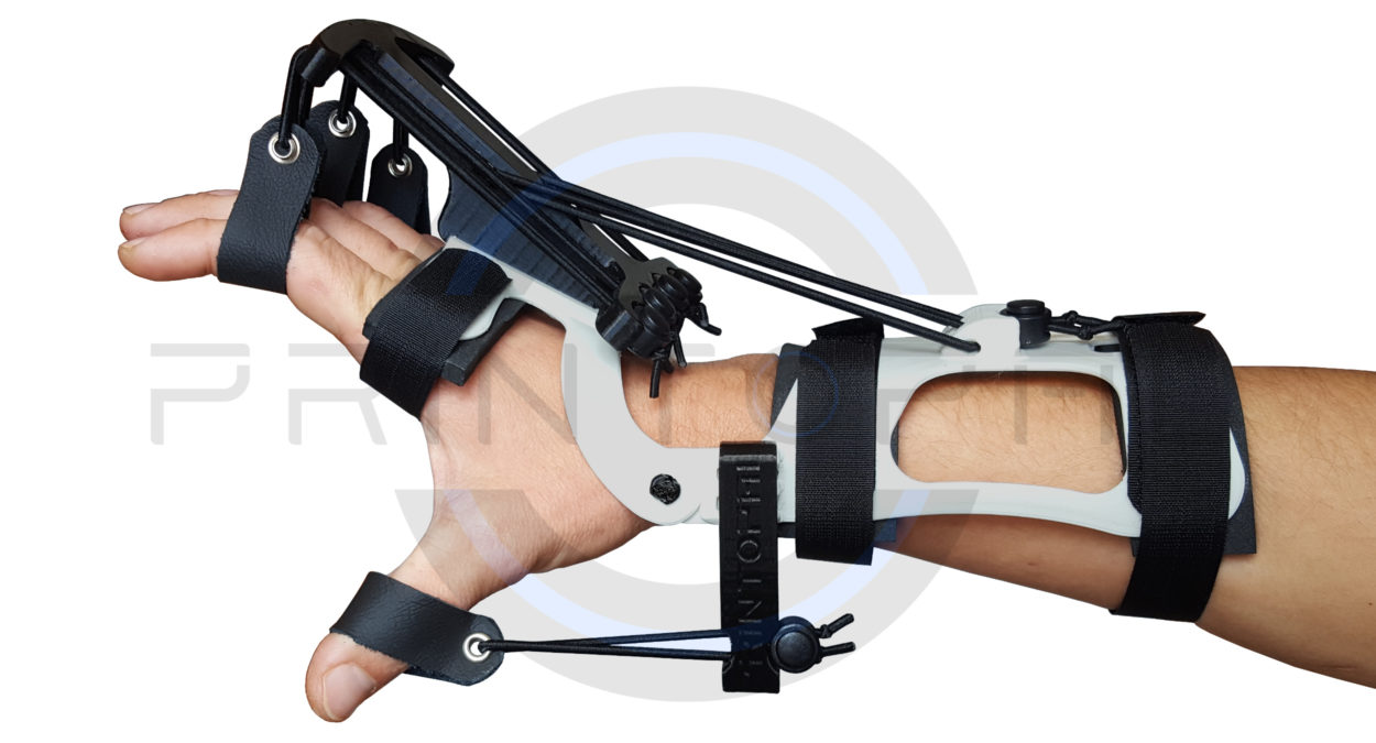 Hand dynamic orthosis extension